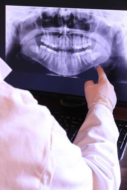 Best Emergency Dentist for Knocked-Out Tooth in Gridley, CA